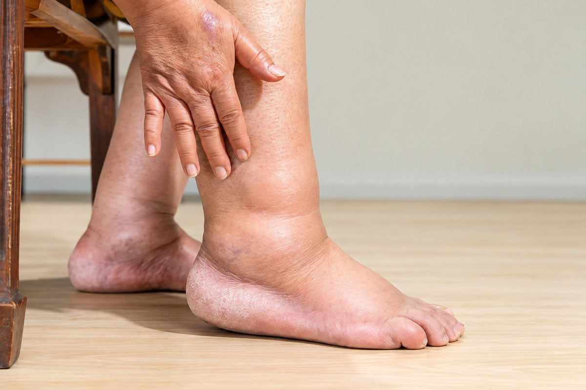 Swelling