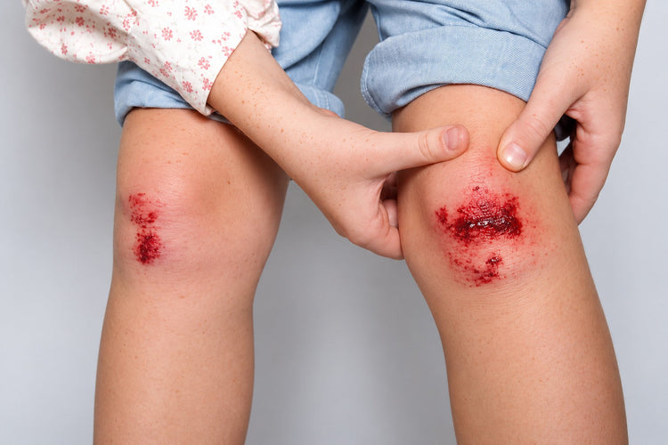 Injuries